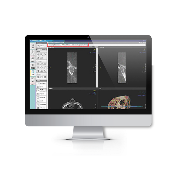 Изображение Програмное обеспечение Cybermed OnDemand3D Server + 6 DENTAL лицензий 901031 1 из 1