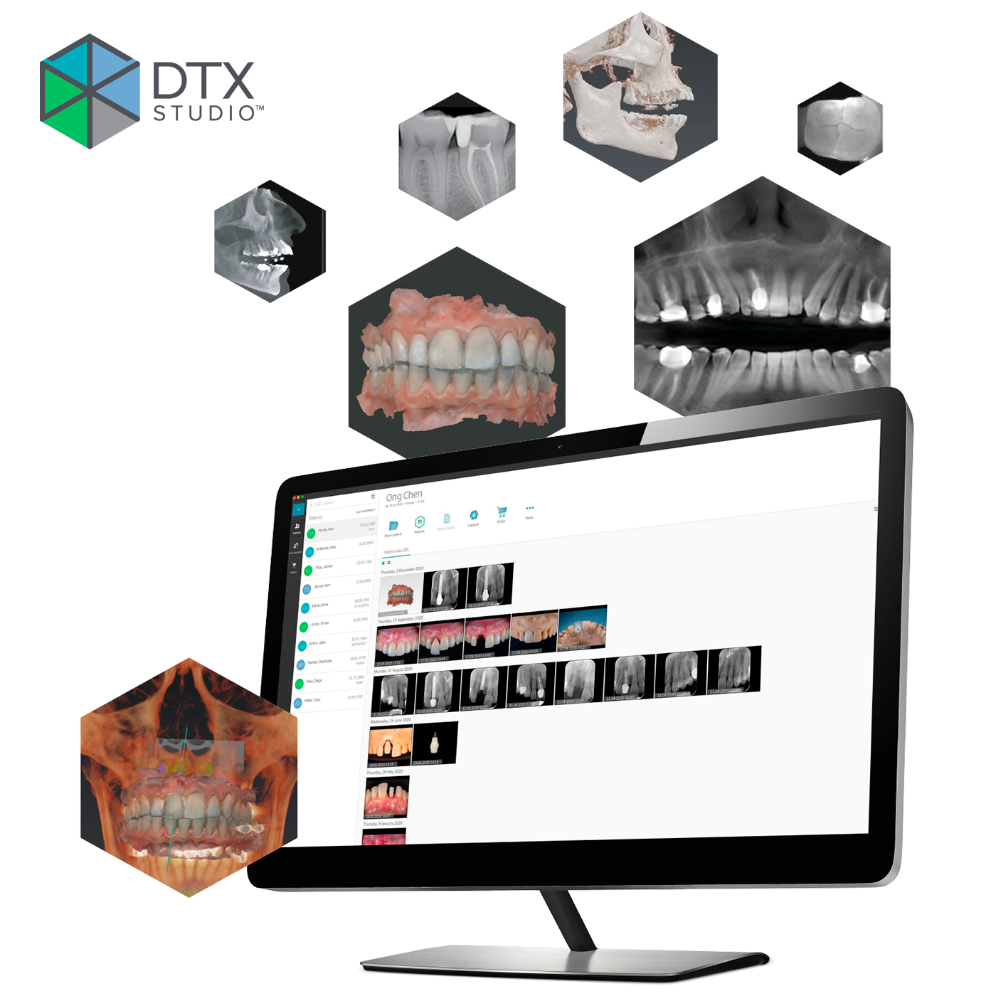 Изображение Программное обеспечение DTX STUDIO CLINIC DEXIS 1 из 3