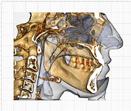 Изображение Програмное обеспечение InVivo 3D Ceph Analysis / Модуль для 3D цефалометрии 0.830.5354 1 из 1